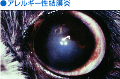 アレルギー性結膜炎