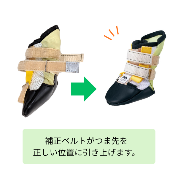 快適な靴　ナックリング用 補正ベルトがつま先を正しい位置に引き上げます。