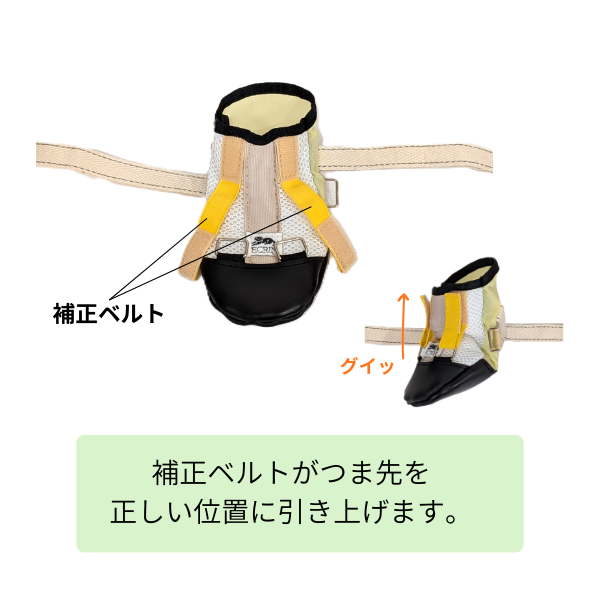 快適な靴　ナックリング用 補正ベルトがつま先を正しい位置に引き上げます。